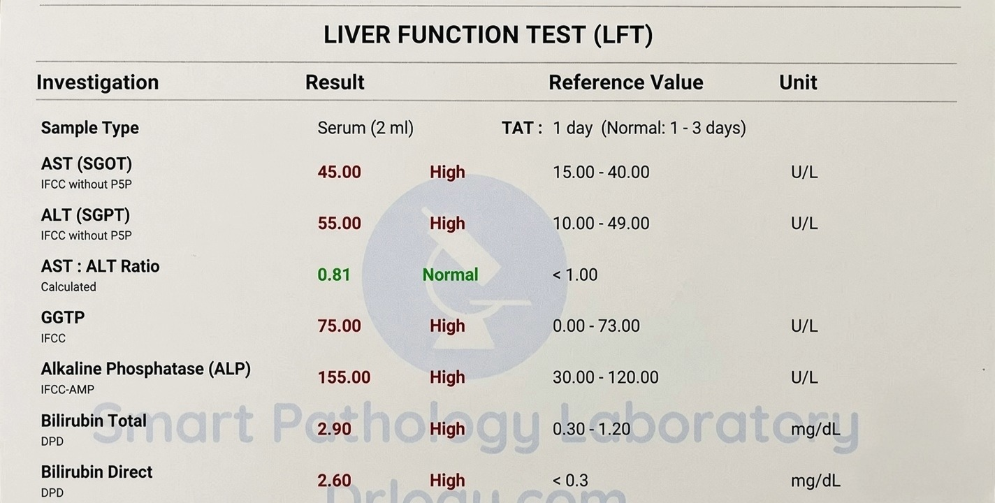 Liver function test panel